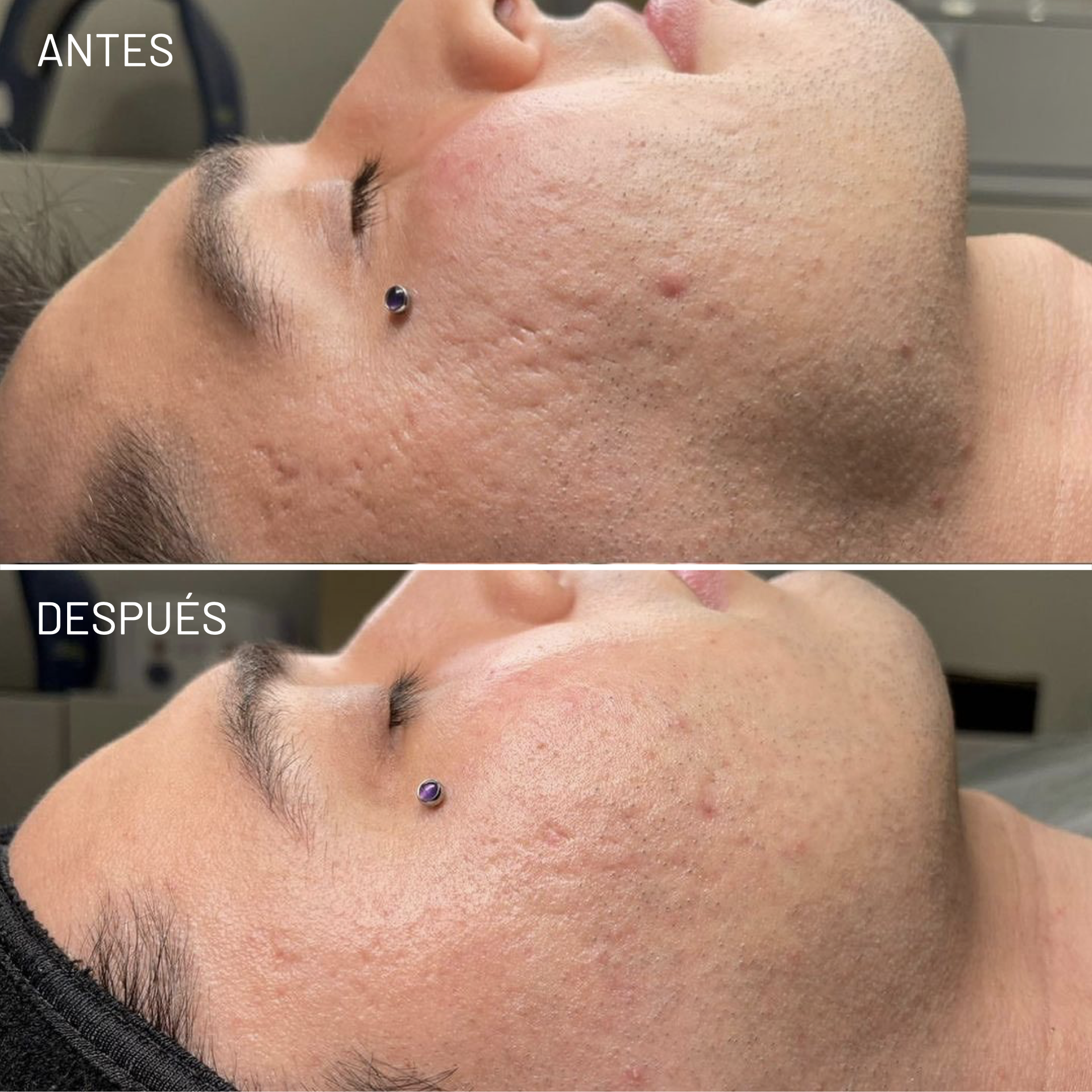 *Cortesía de Celluma