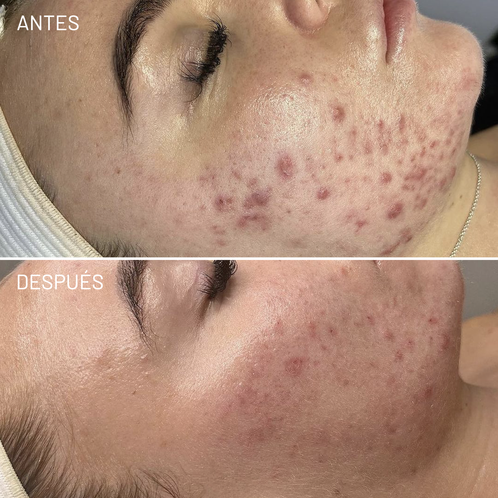 *Cortesía de Celluma