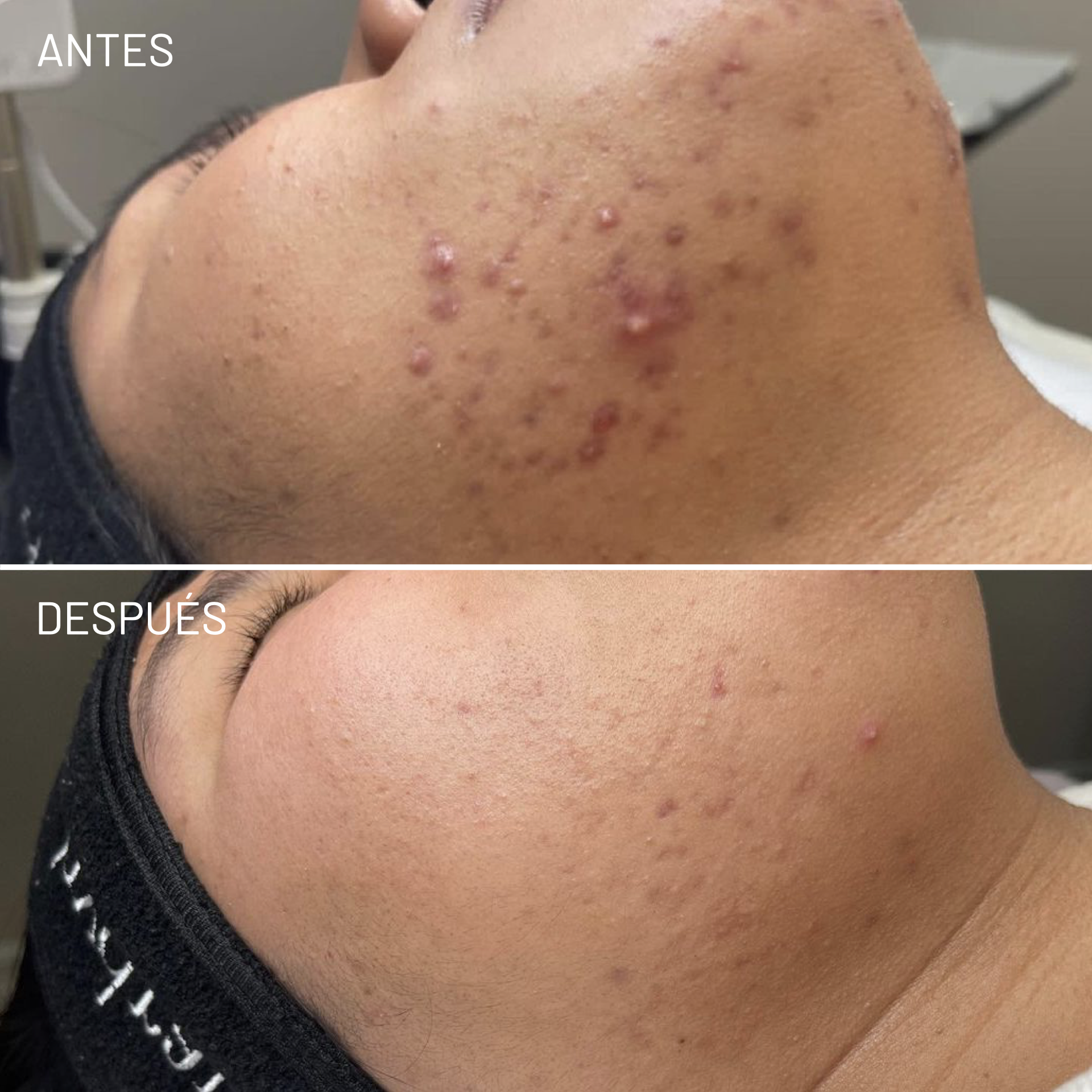 *Cortesía de Celluma