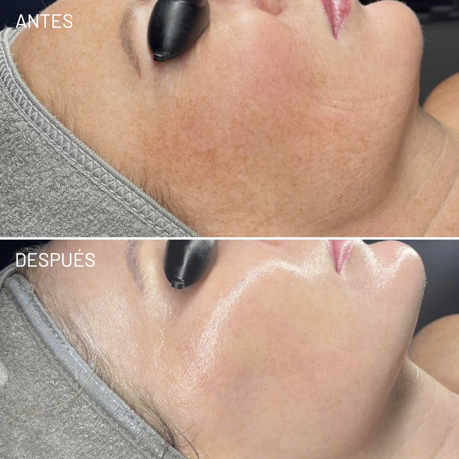 *Cortesía de Celluma
