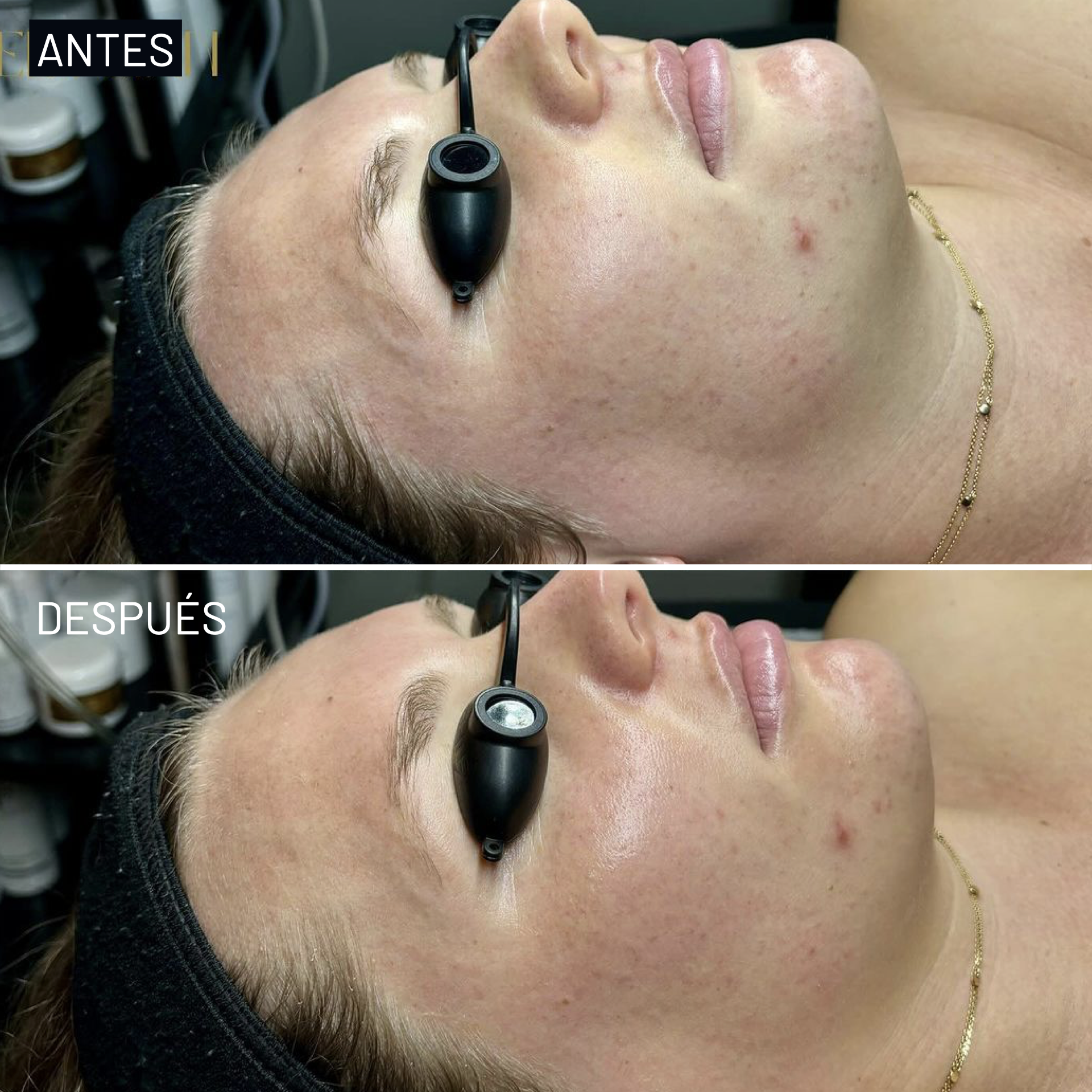 *Cortesía de Celluma