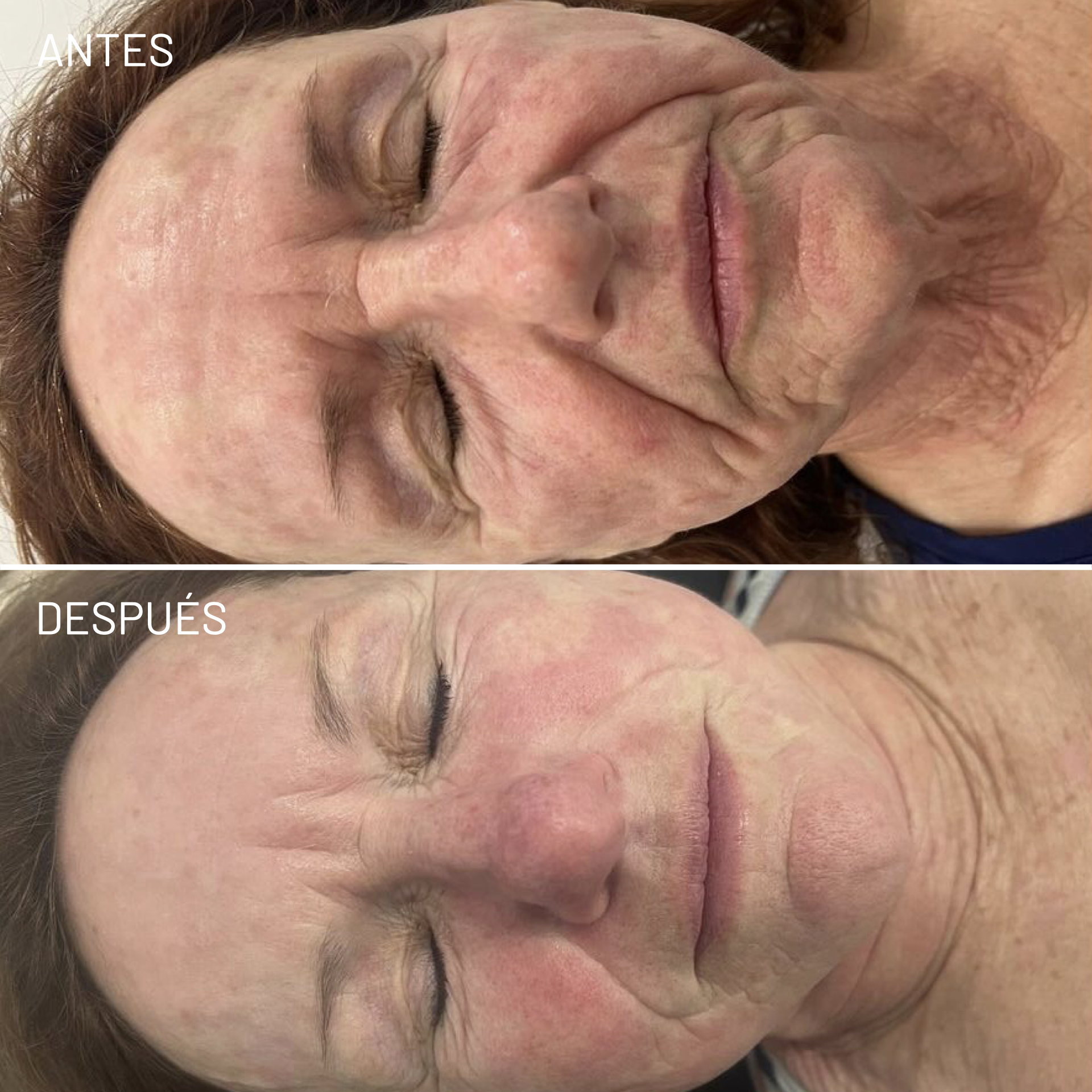 *Cortesía de Celluma