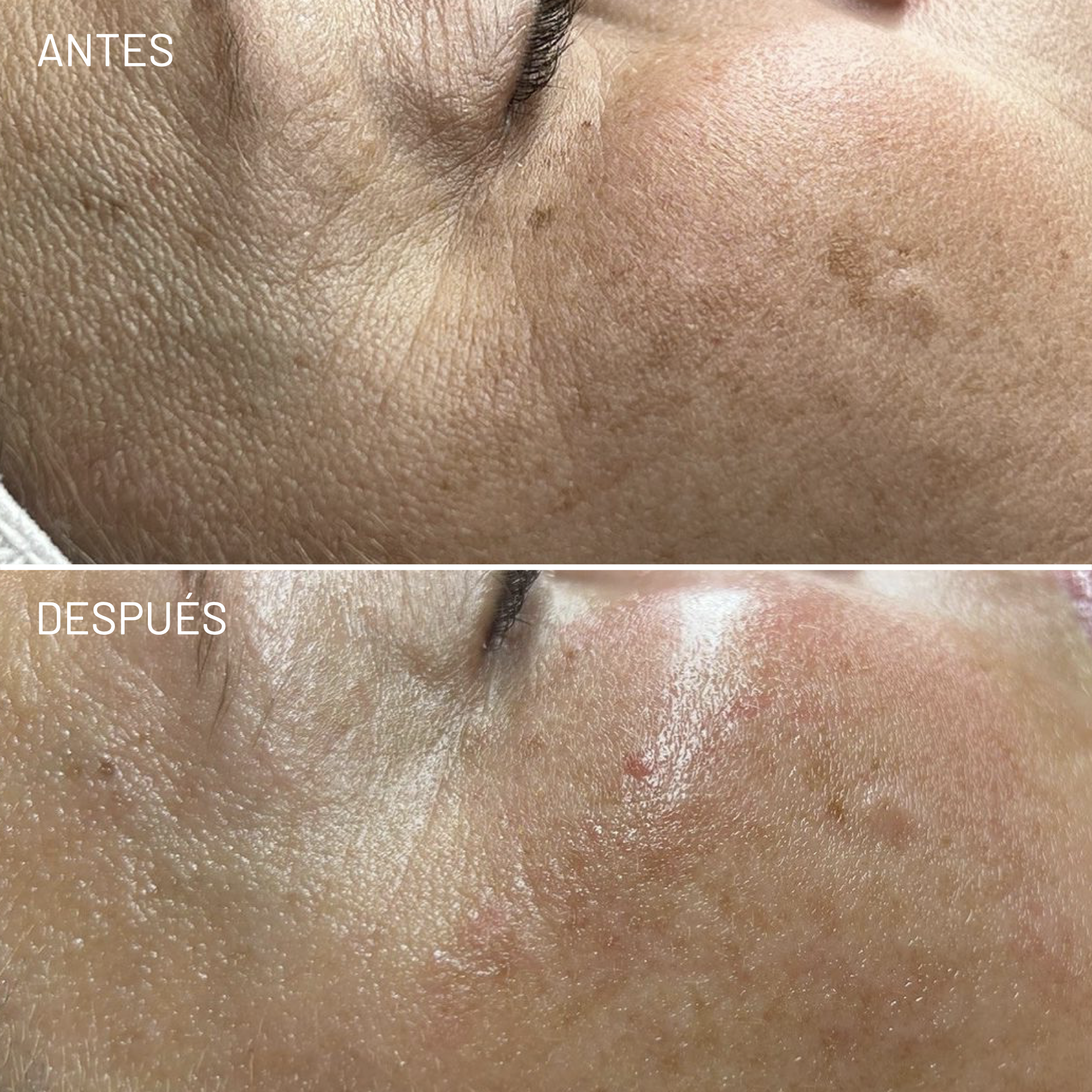 *Cortesía de Celluma