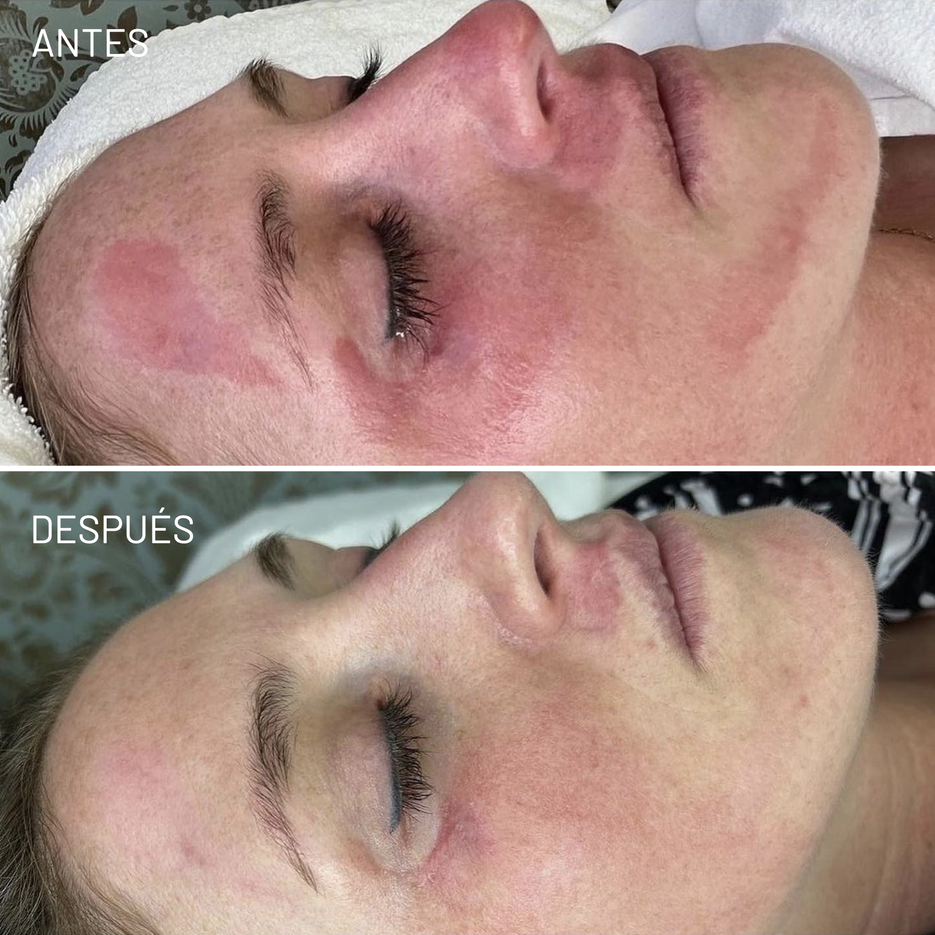 *Cortesía de Celluma