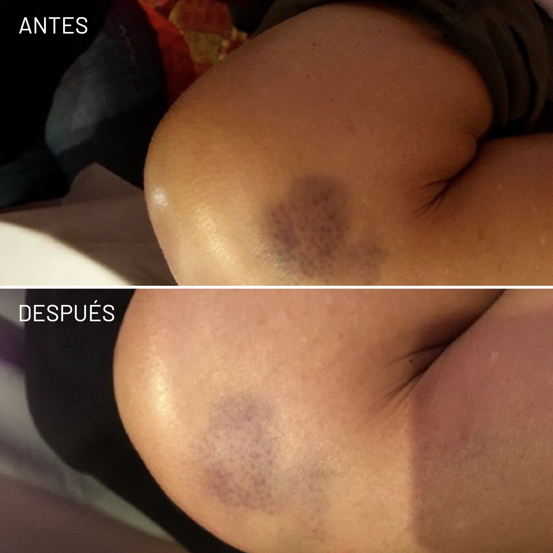 *Cortesía de Celluma