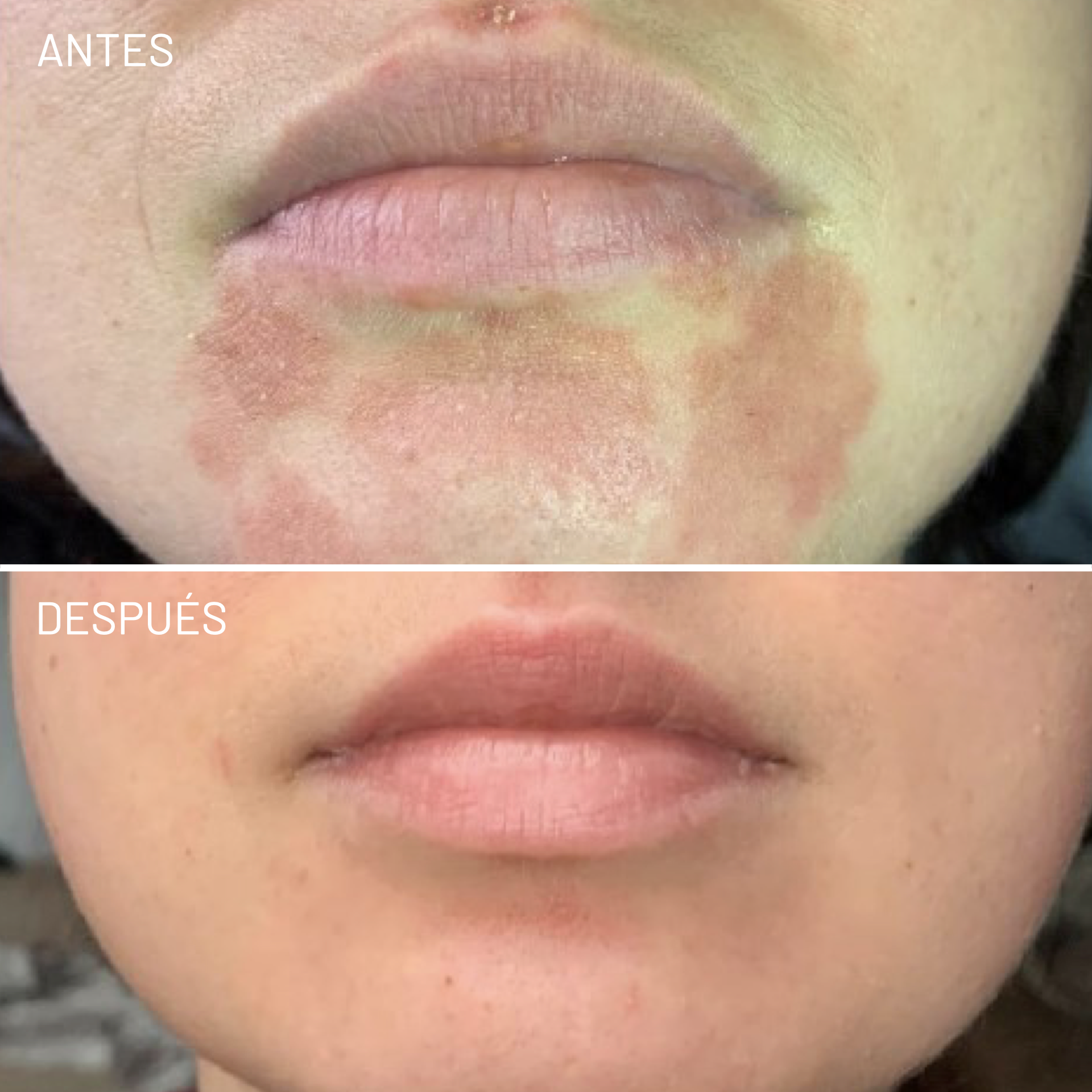 *Cortesía de Celluma