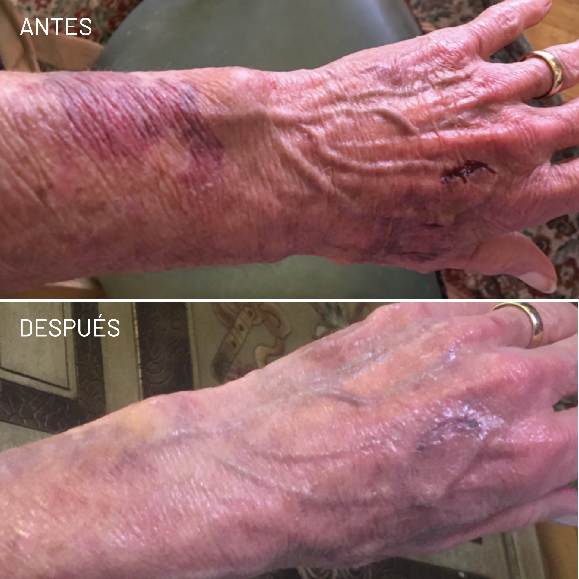 *Cortesía de Celluma
