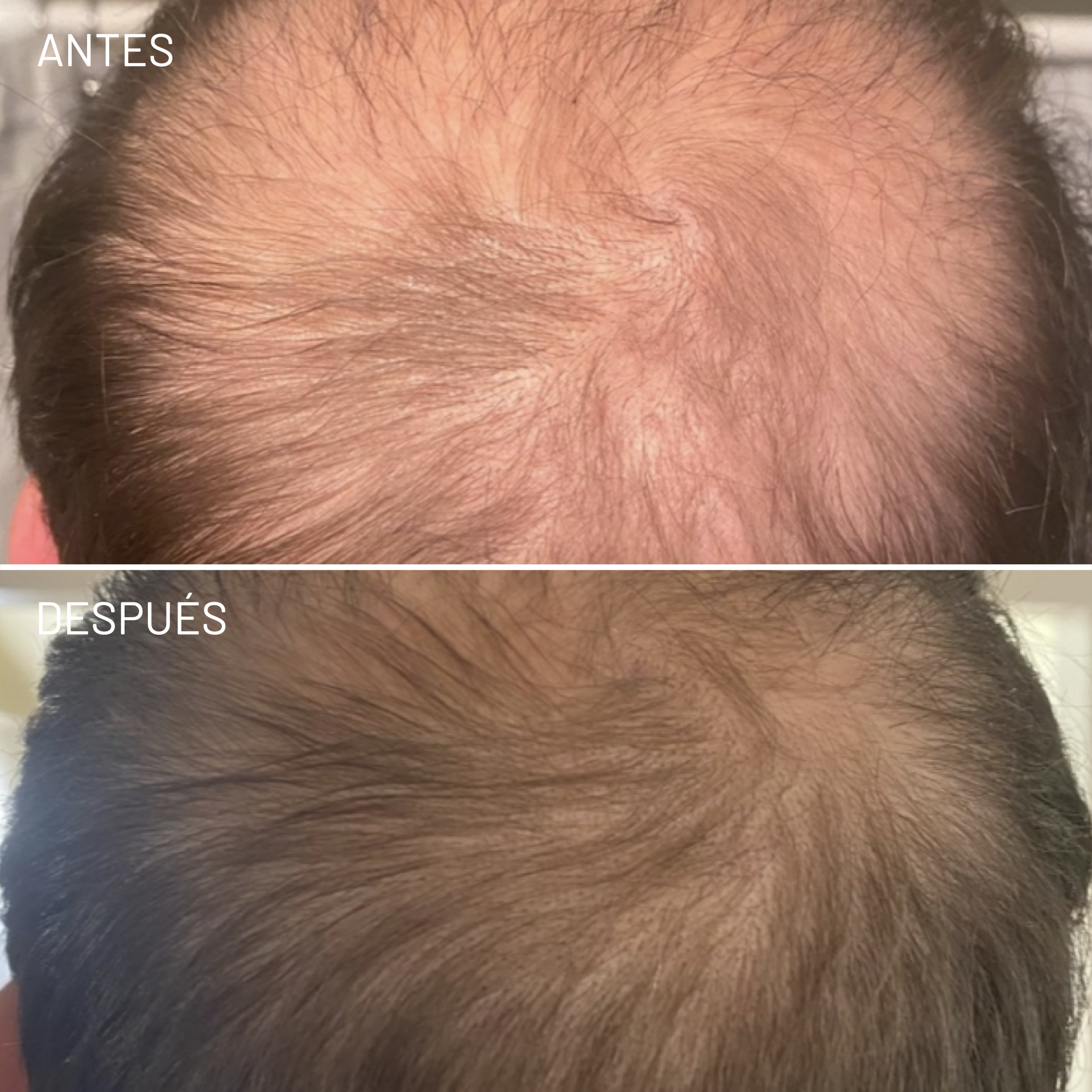 *Cortesía de Celluma