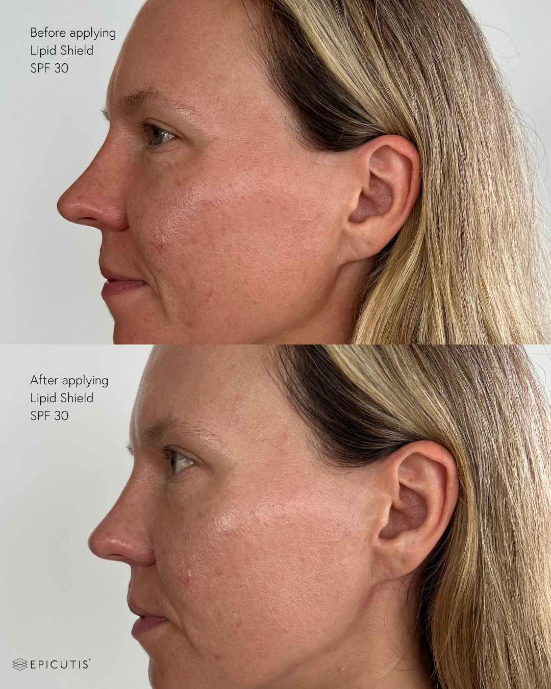 Evgenia - Before and Afters lipid shield